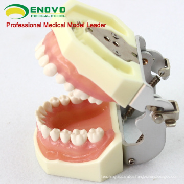 DENTAL27(12609) Treating Periodontal Diseases Training Jaw Models